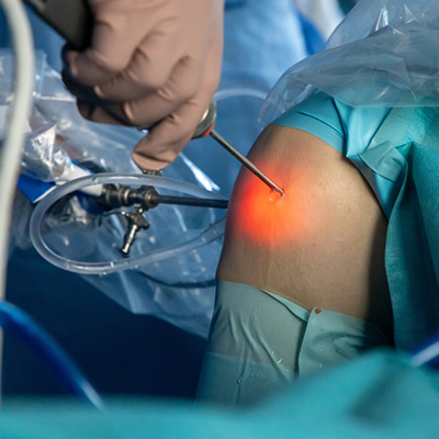 Arthroscopy in Guntur